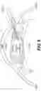 Fig. 06 - EYE SURGERY METHOD USING SURGICAL CANNULATED INSTRUMENT