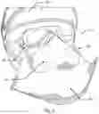 Fig. 04 - Breath deflector and method of use