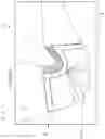 Fig. 02 - Wearable liquid silicone rubber product