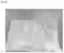 Fig. 09 - DISPOSABLE DIAPER