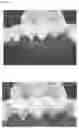 Fig. 14 - DISPOSABLE DIAPER