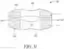 Fig. 09 - ABSORBENT ARTICLE WITH REUSABLE BELT AND METHODS FOR MANUFACTURING THEREOF