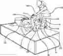 Fig. 01 - Patient Turning Device