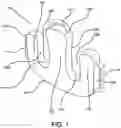 Fig. 02 - Patient Turning Device