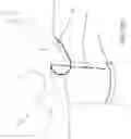 Fig. 45 - ADAPTIVE ARM SUPPORT SYSTEMS AND METHODS FOR USE