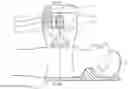 Fig. 01 - CHEST COMPRESSION DEVICE