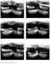 Fig. 05 - ACID RESISTANT COMPOSITION HAVING IMPROVED SOLUBILITY