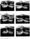 Fig. 06 - ACID RESISTANT COMPOSITION HAVING IMPROVED SOLUBILITY