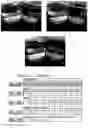 Fig. 07 - ACID RESISTANT COMPOSITION HAVING IMPROVED SOLUBILITY