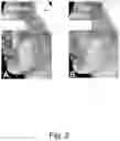 Fig. 03 - STEM CELL STIMULATING COMPOSITIONS AND METHODS
