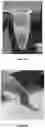 Fig. 14 - LIPID BODY COMPOSITIONS, PRODUCTS MADE THEREFROM, METHODS OF MAKING SAME, AND METHODS OF USE