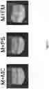 Fig. 08 - REHYDRATABLE, MORPHOLOGICALLY DIVERSE NANOCARRIER POWDERS