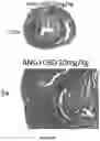 Fig. 11 - CANNABIDIOL COMPOSITIONS FOR USE IN TREATING HEART CONDITIONS