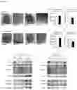 Fig. 08 - Combination Therapy Based on PD-1 Signaling Inhibitors