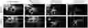 Fig. 01 - USE OF NITRIC OXIDE SYNTHASE PATHWAY INHIBITOR IN PERPARATION OF MEDICINE
