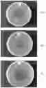 Fig. 02 - Compositions for removing necrotic or infected tissues from body surface lesions and from oral cavity