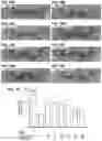 Fig. 11 - Co-Administration Therapy to Prevent Neurodegeneration and Enhance Neuroprotection