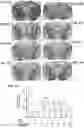 Fig. 12 - Co-Administration Therapy to Prevent Neurodegeneration and Enhance Neuroprotection