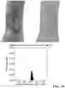 Fig. 04 - TOPICAL FORMULATIONS AND INSTILLATES, KITS, AND METHODS FOR TREATING INTEGUMENTARY WOUNDS, AND USES THEREOF
