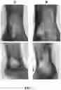 Fig. 10 - TOPICAL FORMULATIONS AND INSTILLATES, KITS, AND METHODS FOR TREATING INTEGUMENTARY WOUNDS, AND USES THEREOF