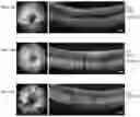 Fig. 08 - COMPOSITIONS AND METHODS FOR RESCUING RETINAL AND CHOROIDAL STRUCTURE AND FUNCTION