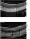 Fig. 12 - COMPOSITIONS AND METHODS FOR RESCUING RETINAL AND CHOROIDAL STRUCTURE AND FUNCTION