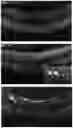 Fig. 16 - COMPOSITIONS AND METHODS FOR RESCUING RETINAL AND CHOROIDAL STRUCTURE AND FUNCTION