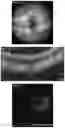 Fig. 17 - COMPOSITIONS AND METHODS FOR RESCUING RETINAL AND CHOROIDAL STRUCTURE AND FUNCTION