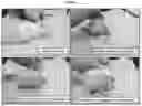 Fig. 02 - COMPOUNDS AND COMPOSITIONS FOR THE TREATMENT OF MUSCULAR DISORDERS AND BONE DISORDERS