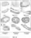 Fig. 09 - METHODS FOR TREATING INFLAMMATORY BOWEL DISEASE