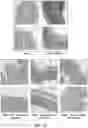 Fig. 15 - METHODS FOR TREATING INFLAMMATORY BOWEL DISEASE