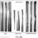 Fig. 17 - METHODS FOR TREATING INFLAMMATORY BOWEL DISEASE