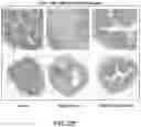 Fig. 20 - METHODS FOR TREATING INFLAMMATORY BOWEL DISEASE