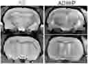 Fig. 01 - Method for Treatment of Alzheimer's Disease