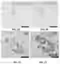 Fig. 05 - Method for Treatment of Alzheimer's Disease