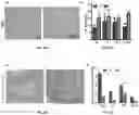 Fig. 38 - Method for Treatment of Alzheimer's Disease
