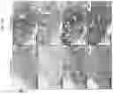 Fig. 32 - CANCER THERAPEUTIC METHODS