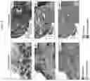 Fig. 33 - CANCER THERAPEUTIC METHODS