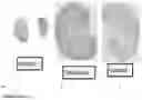 Fig. 11 - METHODS AND COMPOSITIONS FOR THE PREVENTION AND TREATMENT OF ISCHEMIA REPERFUSION INJURY AND INFECTION