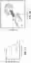Fig. 08 - MODULATING RESISTANCE TO BCL-2 INHIBITORS