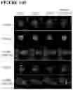 Fig. 63 - COMBINATIONS OF MULTIPLE CHIMERIC ANTIGEN RECEPTORS FOR IMMUNOTHERAPY