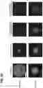 Fig. 17 - COMBINATION OF A T CELL THERAPY AND (S)-3-[4-(4-MORPHOLIN-4-YLMETHYL-BENZYLOXY)-L-OXO-L,3-DIHYDRO-ISOINDOL-2-YL]-PIPERIDINE-2,6-DIONE