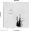 Fig. 01 - Compositions and Methods for Inhibiting T Cell Exhaustion