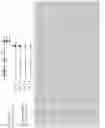 Fig. 15 - COMPOSITIONS AND METHODS FOR TREATING SICKLE CELL DISEASE