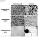 Fig. 04 - MESENCHYMAL STEM CELL EXPRESSING TRAIL AND CD, AND USE THEREOF