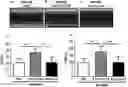 Fig. 01 - Use of Faecalibacterium prausnitzii in preparation of medicine for treating pathological ventricular remodeling and/or heart failure following myocardial infarction