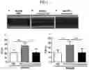 Fig. 02 - Use of Faecalibacterium prausnitzii in preparation of medicine for treating pathological ventricular remodeling and/or heart failure following myocardial infarction