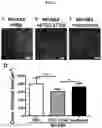 Fig. 03 - Use of Faecalibacterium prausnitzii in preparation of medicine for treating pathological ventricular remodeling and/or heart failure following myocardial infarction