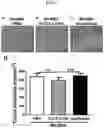 Fig. 04 - Use of Faecalibacterium prausnitzii in preparation of medicine for treating pathological ventricular remodeling and/or heart failure following myocardial infarction