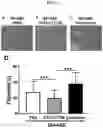 Fig. 05 - Use of Faecalibacterium prausnitzii in preparation of medicine for treating pathological ventricular remodeling and/or heart failure following myocardial infarction